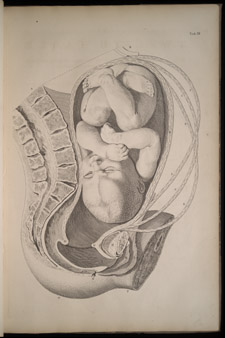 Smellie, A Sett of Anatomical Tables…, tab XII