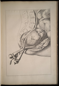 Smellie, A Sett of Anatomical Tables…, tab XVI