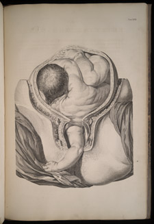 Smellie, A Sett of Anatomical Tables…, tab XXXII