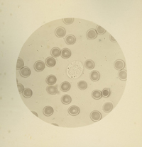 Photomicrograph of the blood of a fatal case of yellow fever. From: Sternberg, George Miller, and Tayloe Gwathmey. Photomicrographs From Negatives of Yellow Fever Studies : Made In Havana for the Havana Commission for Investigation of Yellow Fever by Order of the National Board of Health. Havana: circa 1879.