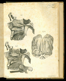 Scarpa, Anatomicarum annotationum…, tab II